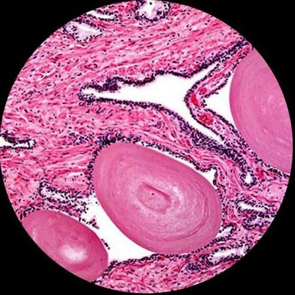 AmScope B100 Series Biological Binocular Compound Microscope 40X-2000X Magnification with 20W Halogen, Mechanical Stage and 1MP Camera