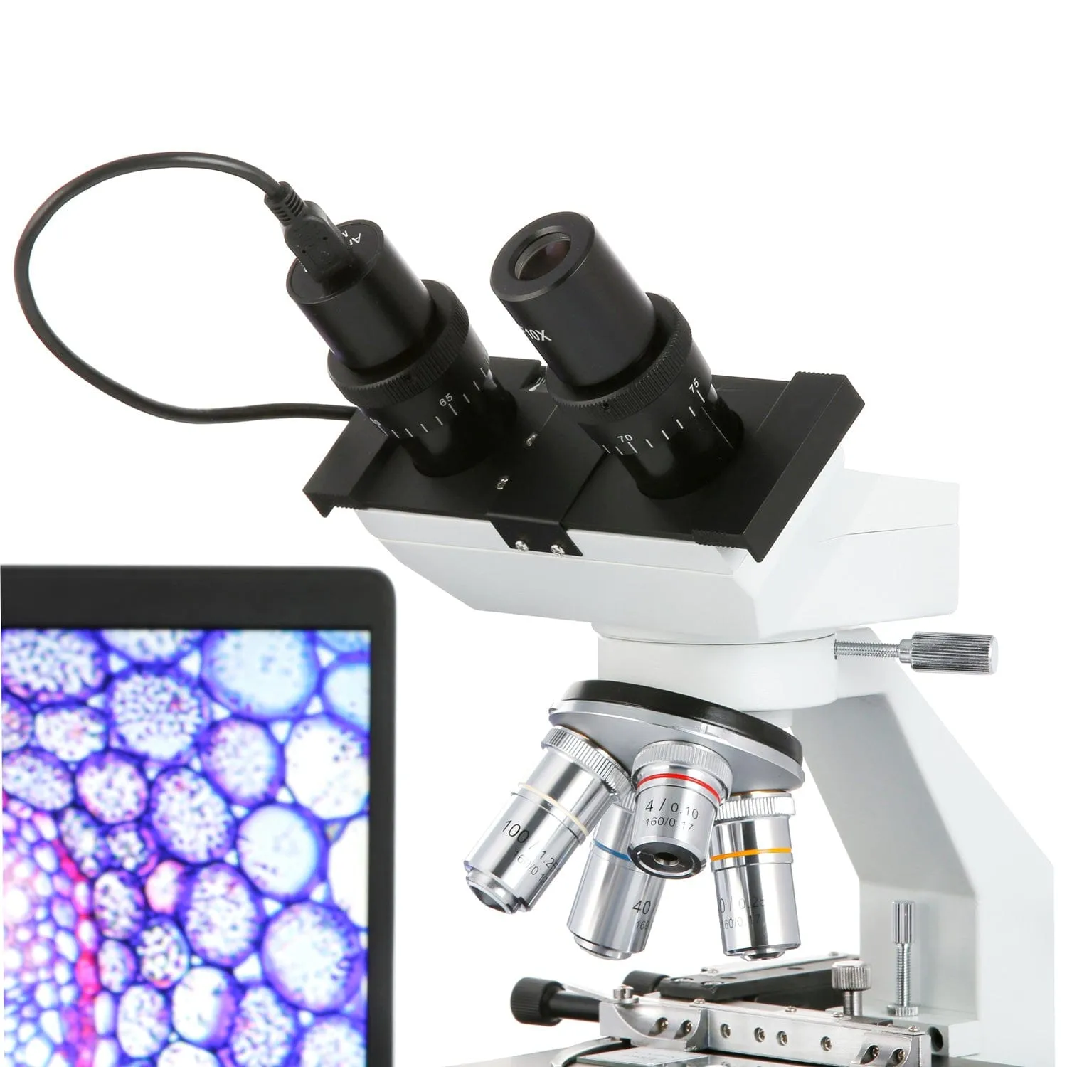 AmScope B100 Series Biological Binocular Compound Microscope 40X-2000X Magnification with Halogen, Mech. Stage and 3MP Digital Eyepiece