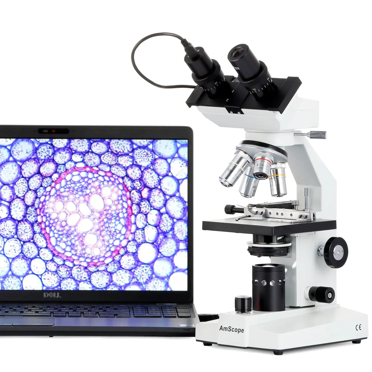 AmScope B100 Series Biological Binocular Compound Microscope 40X-2000X Magnification with Halogen, Mech. Stage and 3MP Digital Eyepiece