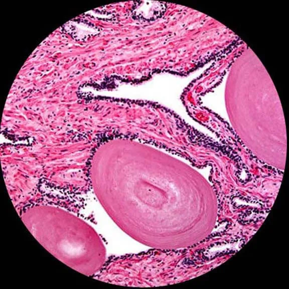 AmScope B120 Series Binocular Compound Microscope 40X-2500X Magnification with LED, Siedentopf Head, 50pc Blank Slides and 10MP Digital Camera
