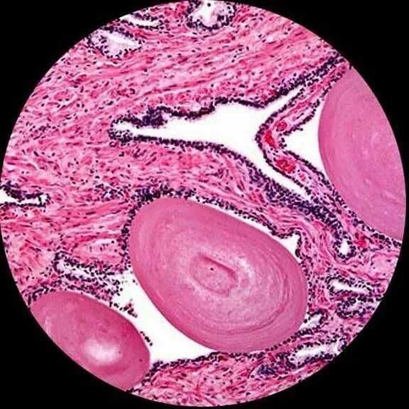 AmScope B120 Series Binocular Compound Microscope 40X-2500X Magnification with LED, Siedentopf Head and 25 Prepared Slides